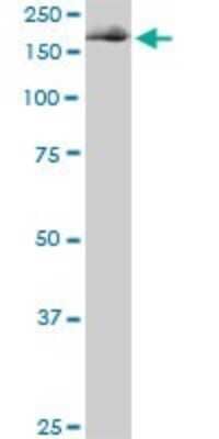 Western Blot: eIF4G1 Antibody (3A10) [H00001981-M01]