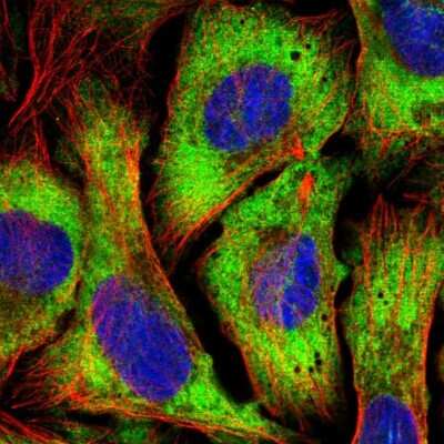 Immunocytochemistry/ Immunofluorescence: eIF4G1 Antibody [NBP1-84868]