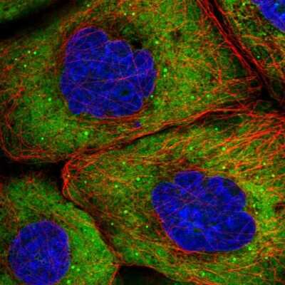 Immunocytochemistry/ Immunofluorescence: eIF4G1 Antibody [NBP2-55105]