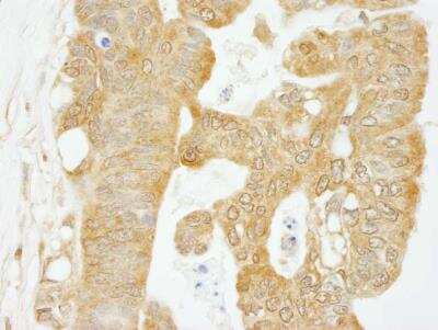 Immunohistochemistry-Paraffin: eIF4G1 Antibody [NB100-93317]