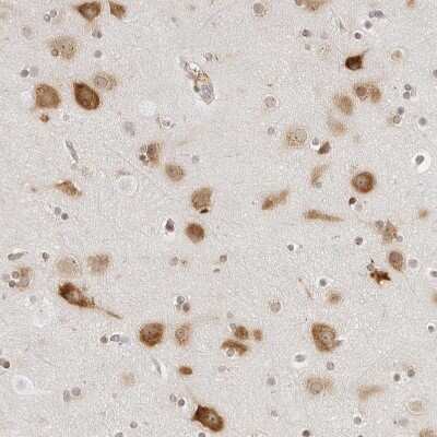Immunohistochemistry-Paraffin: eIF4G1 Antibody [NBP1-84868]