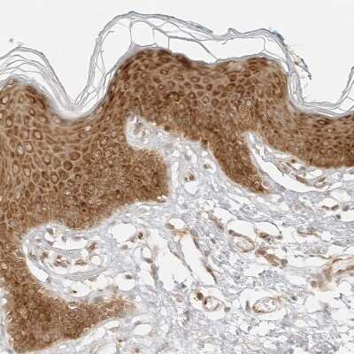 Immunohistochemistry-Paraffin: eIF4G1 Antibody [NBP1-84868]