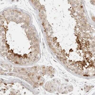 Immunohistochemistry-Paraffin: eIF4G1 Antibody [NBP1-84868]