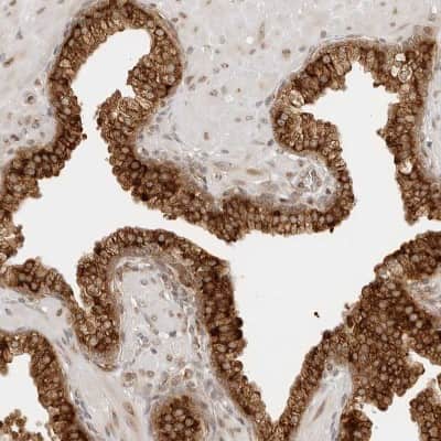 Immunohistochemistry-Paraffin: eIF4G1 Antibody [NBP1-84868]