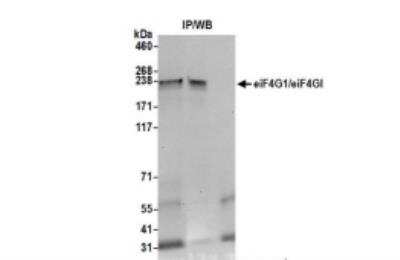 Immunoprecipitation: eIF4G1 Antibody [NB100-268]