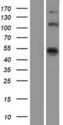 Western Blot: eIF4G1 Overexpression Lysate [NBP2-07806]