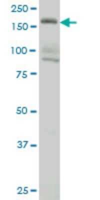 Western Blot: eIF4GII Antibody (1B4) [H00008672-M01]