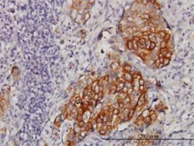 Immunohistochemistry-Paraffin: eIF4GII Antibody (1D7) [H00008672-M02]