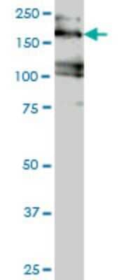 Western Blot: eIF4GII Antibody (1D7) [H00008672-M02]