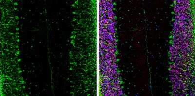 Immunohistochemistry-Frozen: eIF4GII Antibody [NBP2-16309]
