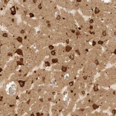 Immunohistochemistry-Paraffin: eIF4GII Antibody [NBP1-84865]