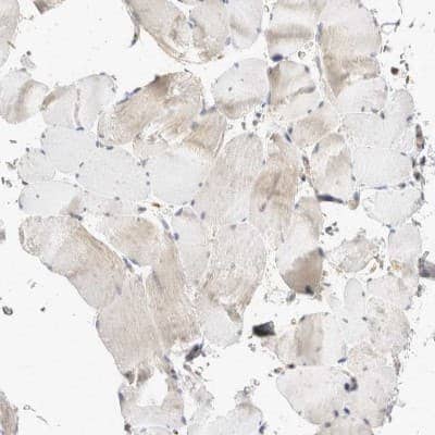Immunohistochemistry-Paraffin: eIF4GII Antibody [NBP1-84865]