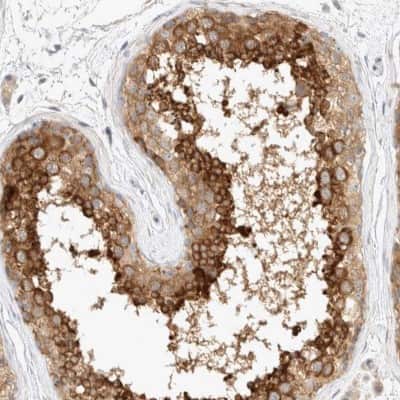 Immunohistochemistry-Paraffin: eIF4GII Antibody [NBP1-84865]