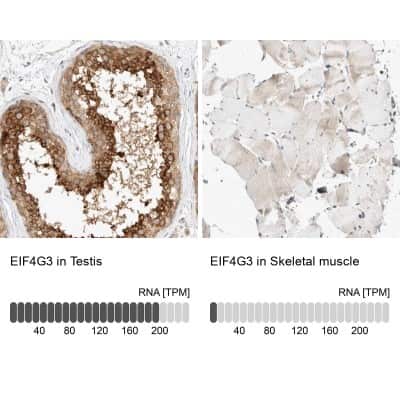 Immunohistochemistry-Paraffin: eIF4GII Antibody [NBP1-84865]