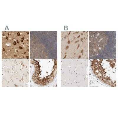 Immunohistochemistry-Paraffin: eIF4GII Antibody [NBP1-84865]
