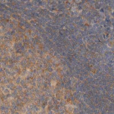 Immunohistochemistry-Paraffin: eIF4GII Antibody [NBP1-84865]