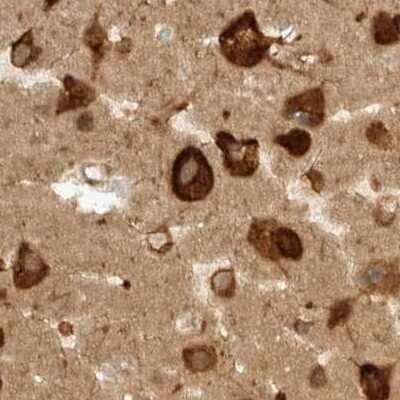 Immunohistochemistry-Paraffin: eIF4GII Antibody [NBP1-84865]