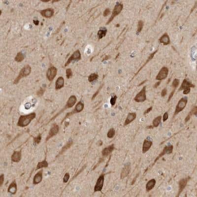 Immunohistochemistry-Paraffin: eIF4GII Antibody [NBP1-84866]