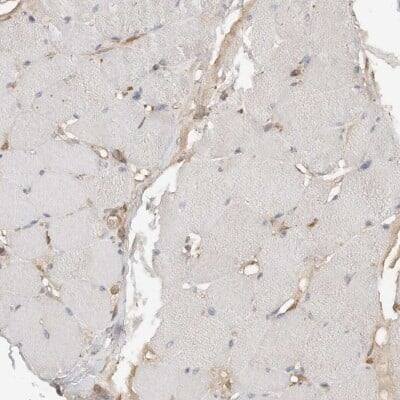 Immunohistochemistry-Paraffin: eIF4GII Antibody [NBP1-84866]