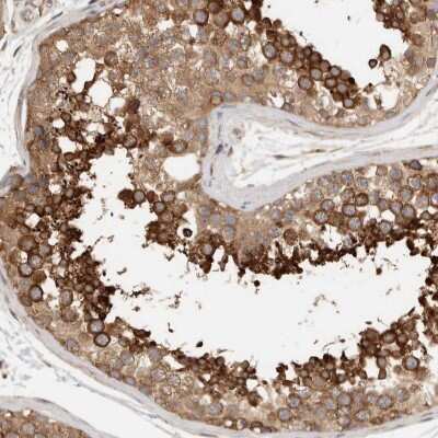 Immunohistochemistry-Paraffin: eIF4GII Antibody [NBP1-84866]