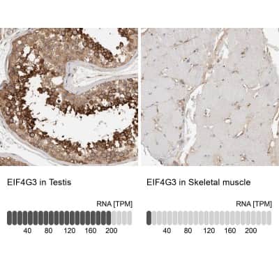 Immunohistochemistry-Paraffin: eIF4GII Antibody [NBP1-84866]