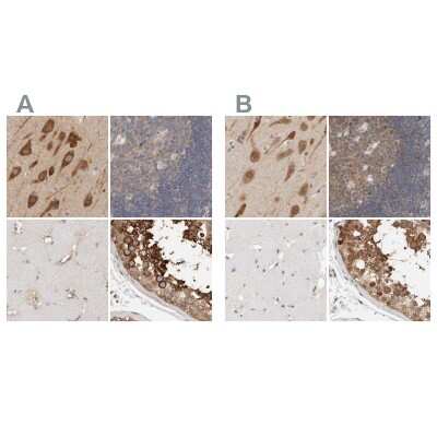 Immunohistochemistry-Paraffin: eIF4GII Antibody [NBP1-84866]