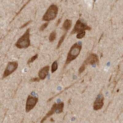 Immunohistochemistry-Paraffin: eIF4GII Antibody [NBP1-84866]
