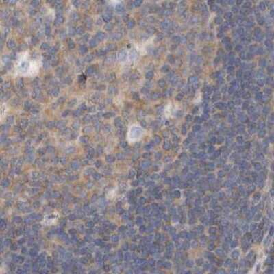 Immunohistochemistry-Paraffin: eIF4GII Antibody [NBP1-84866]