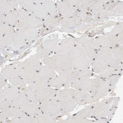 Immunohistochemistry-Paraffin: eIF4GII Antibody [NBP1-84867]