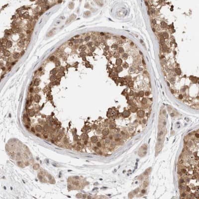 Immunohistochemistry-Paraffin: eIF4GII Antibody [NBP1-84867]
