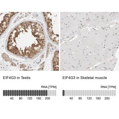 Immunohistochemistry-Paraffin: eIF4GII Antibody [NBP1-84867]