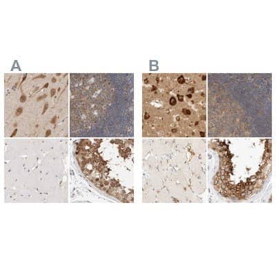 Immunohistochemistry-Paraffin: eIF4GII Antibody [NBP1-84867]