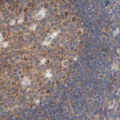 Immunohistochemistry-Paraffin: eIF4GII Antibody [NBP1-84867]