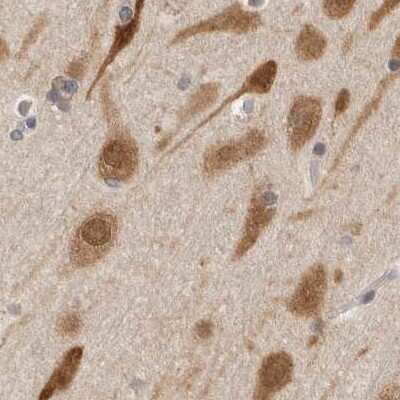 Immunohistochemistry-Paraffin: eIF4GII Antibody [NBP1-84867]