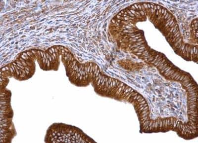 Immunohistochemistry-Paraffin: eIF4GII Antibody [NBP2-16309]