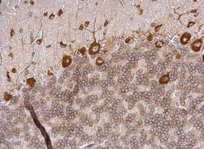 Immunohistochemistry-Paraffin: eIF4GII Antibody [NBP2-16309]