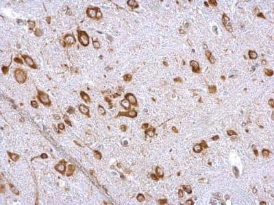 Immunohistochemistry-Paraffin: eIF4GII Antibody [NBP2-16309]