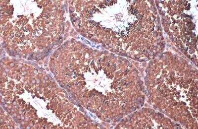 Immunohistochemistry-Paraffin: eIF4GII Antibody [NBP2-16309]
