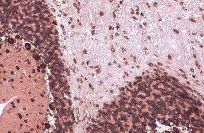 Immunohistochemistry-Paraffin: eIF4GII Antibody [NBP2-16309]