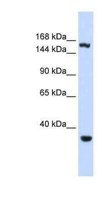 Western Blot: eIF4GII Antibody [NBP1-57533]