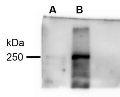 Western Blot: eIF4GII Antibody [NBP2-16309]