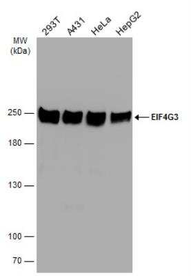 Western Blot: eIF4GII Antibody [NBP2-16309]