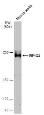 Western Blot: eIF4GII Antibody [NBP2-16309]