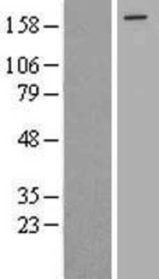 Western Blot: eIF4GII Overexpression Lysate [NBL1-10211]