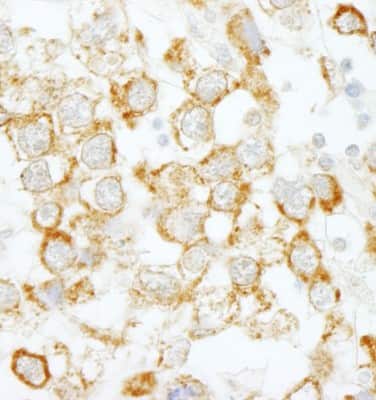 Immunohistochemistry-Paraffin: eIF4H Antibody [NBP1-00105]