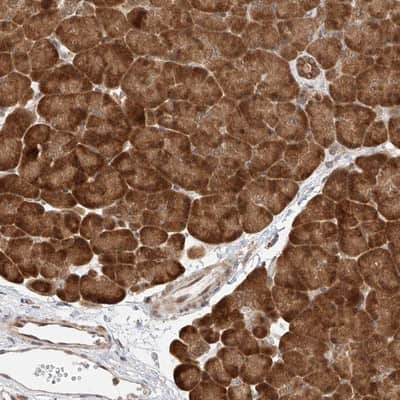 Immunohistochemistry-Paraffin: eIF4H Antibody [NBP1-83057]
