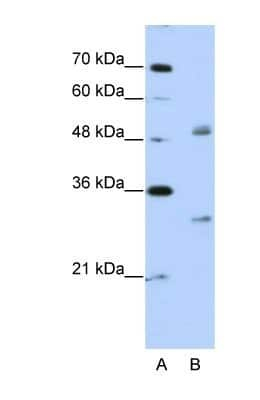 Western Blot: eIF4H Antibody [NBP1-57248]