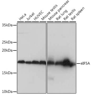 Western Blot: eIF5A Antibody (3R10I7) [NBP3-16409]