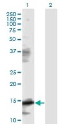 Western Blot: eIF5A Antibody (8C1) [H00001984-M01]