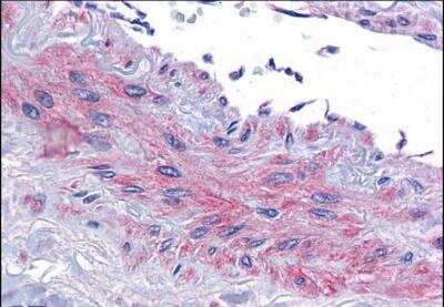 Immunohistochemistry-Paraffin: eIF5A Antibody [NBP1-51982]